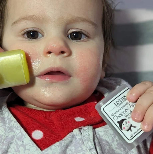 Chapped Apples - Lotus Natural Living 